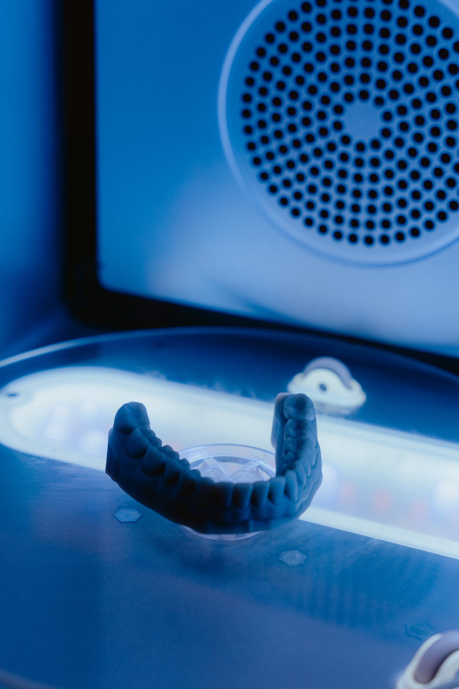 Laboratoire numérique interne du cabinet : empreinte optique et impression 3D